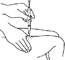 Diabet13.gif (8869 bytes)