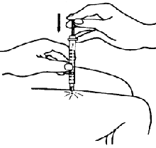 Diabet15.gif (6283 bytes)
