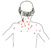 Diabete8.GIF (4822 bytes)